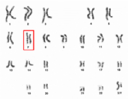 Es un cariotipo humano donde se señala el cromosoma 7