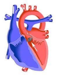 Se observa como se estrecha la aorta justo antes de recibir la sangre de la válvula semilunar