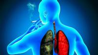 Enfermo de cáncer de pulmón fumando
