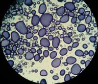 Células de almidón al microscopio electrónico