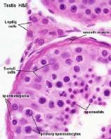 Las células de Sertoli vistas bajo el microscopio.