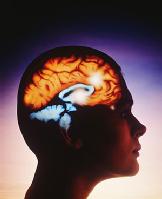 La imagen muestra las partes del cerebro relacionadas con el sueño y el coma.
