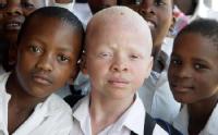 ¿Albinos en África?