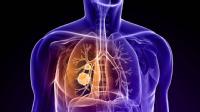 El cáncer de pulmón es un tipo de cáncer que se produce en los tejidos del pulmón normalmente en las células que recubren los conductos de aire del pulmón